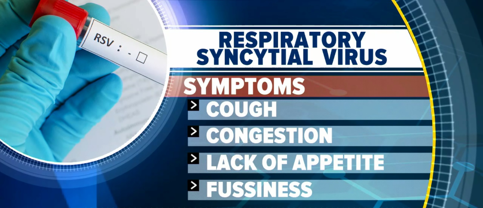 PHOTO: Dr. Jennifer Ashton, chief medical correspondent for ABC News, said RSV first appears like the common cold and symptoms are based on age.