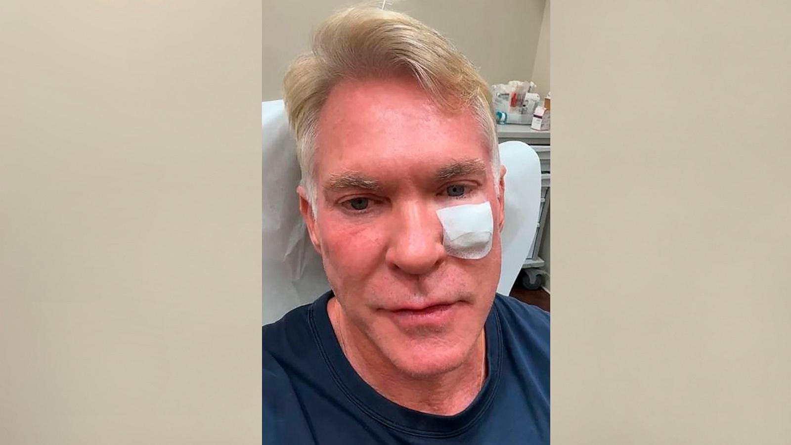 PHOTO: Sam Champion shared an update on Instagram on Oct. 2, 2024, after undergoing surgery to treat skin cancer.