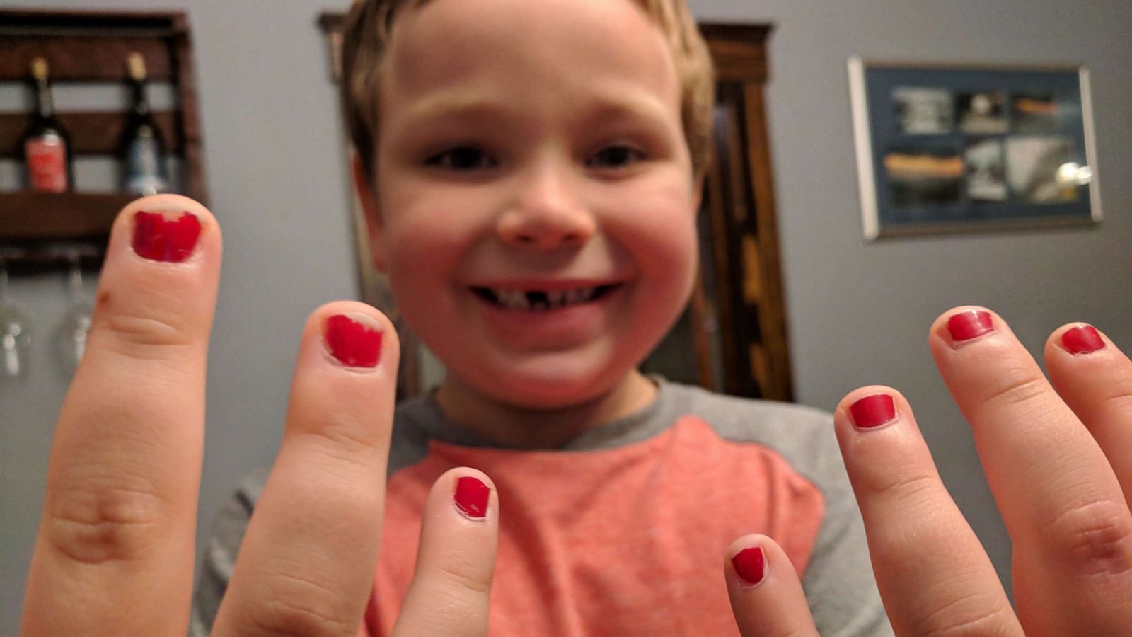 PHOTO: 5-year-old Sam Gouveia was bullied for wearing nail polish to school.