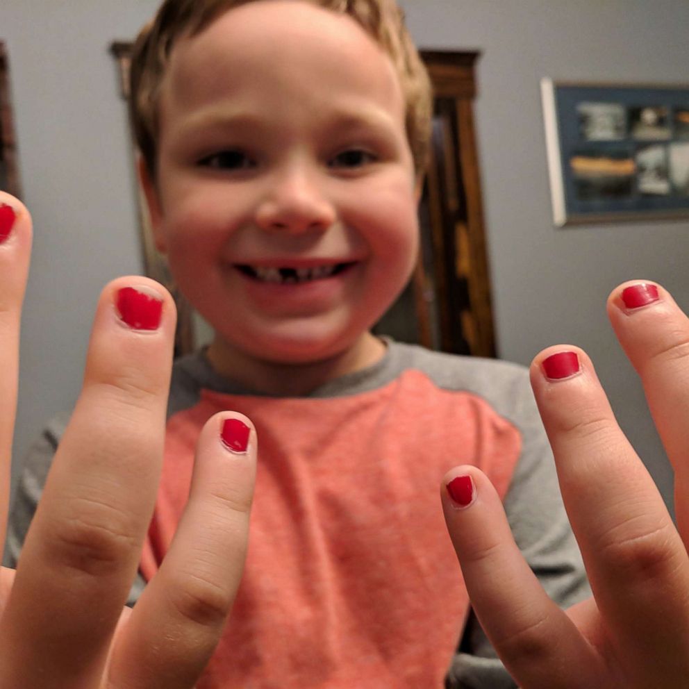 VIDEO: Little boy bullied for nail polish gets confidence from community of strangers