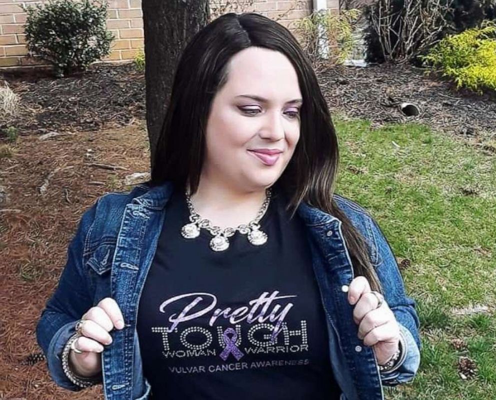 PHOTO: Sandra Hoehler wearing her vulvar cancer awareness shirt in Jersey City, N.J., on May, 17, 2018.