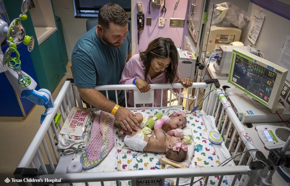 PHOTO: Sandy and Jesse Fuller pose with their twin daughters prior to a separation surgery for the newborns at Texas Children's Hospital.