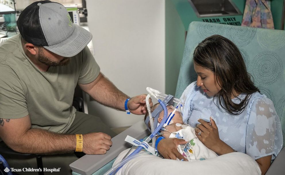 PHOTO: Sandy Fuller holds one of her twin daughters following separation surgery at Texas Children's Hospital.