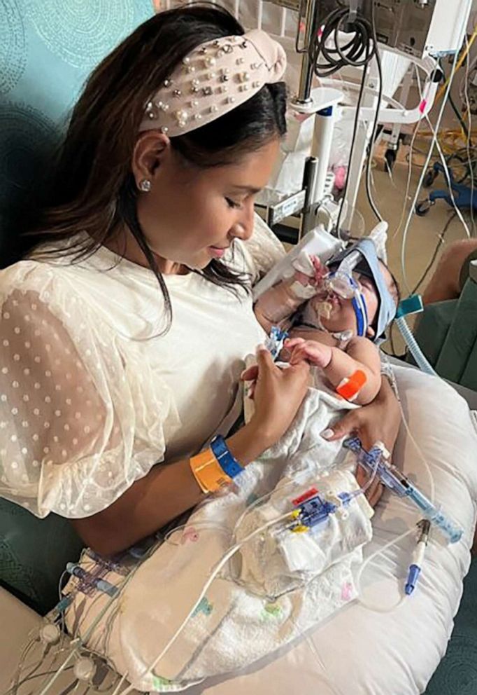 PHOTO: Sandy Fuller holds one of her twin daughters following separation surgery at Texas Children's Hospital.