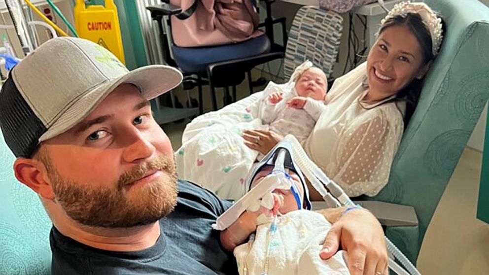 PHOTO: Sandy and Jesse Fuller hold their twin daughters after the babies underwent successful separation surgery.