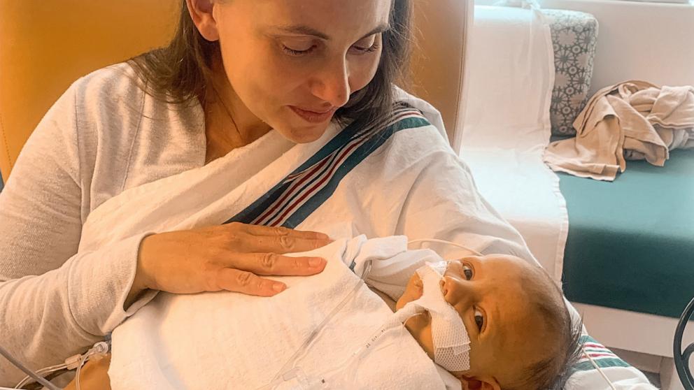 PHOTO: Sarah Love holds her son Lincoln, who was diagnosed with Alagille syndrome.