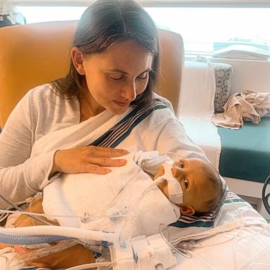 PHOTO: Sarah Love holds her son Lincoln, who was diagnosed with Alagille syndrome.