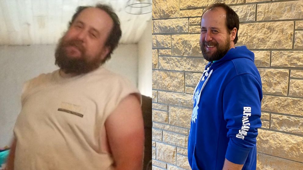 PHOTO: Sean Kelley decided to be his son's living donor and lost 40 pounds to help save his son's life.