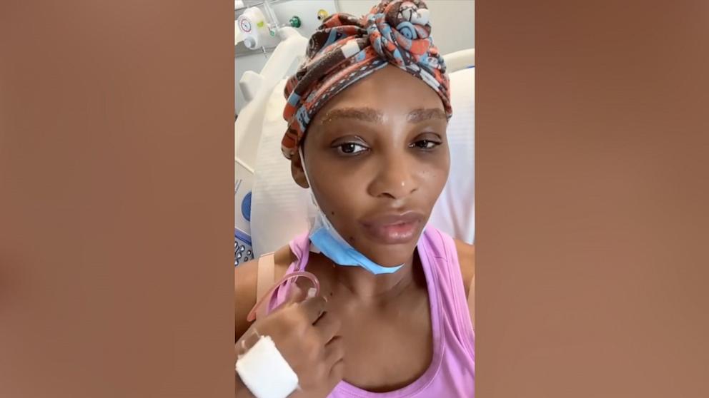 PHOTO: Serena Williams shared on TikTok that she had a grapefruit-sized cyst removed from her neck.