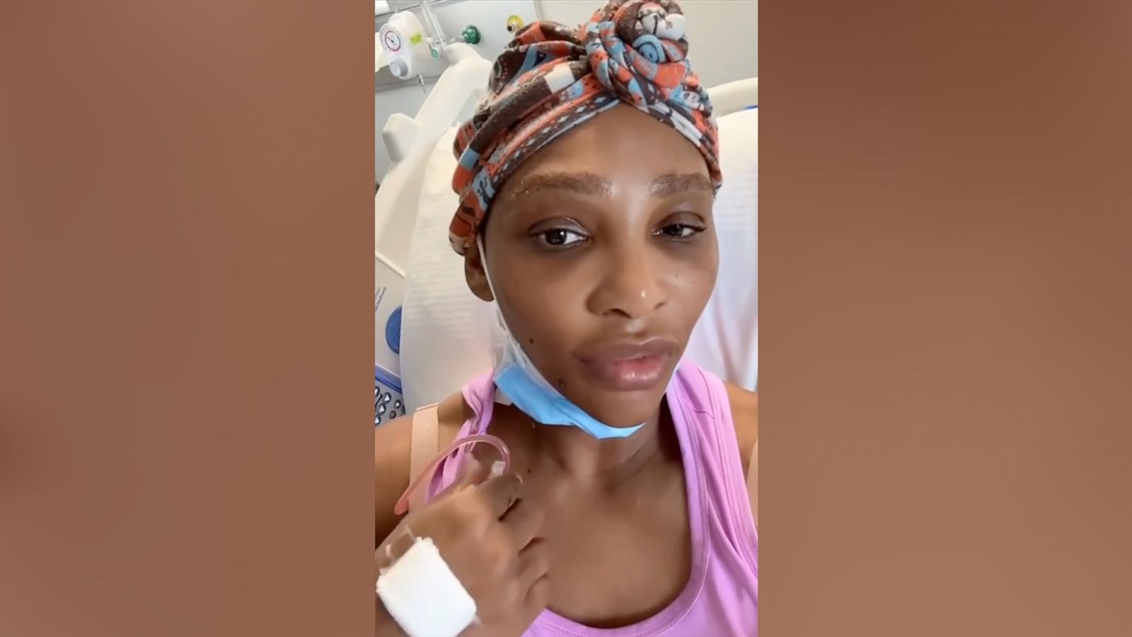 PHOTO: Serena Williams shared on TikTok that she had a grapefruit-sized cyst removed from her neck.