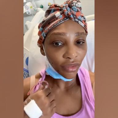 PHOTO: Serena Williams shared on TikTok that she had a grapefruit-sized cyst removed from her neck.