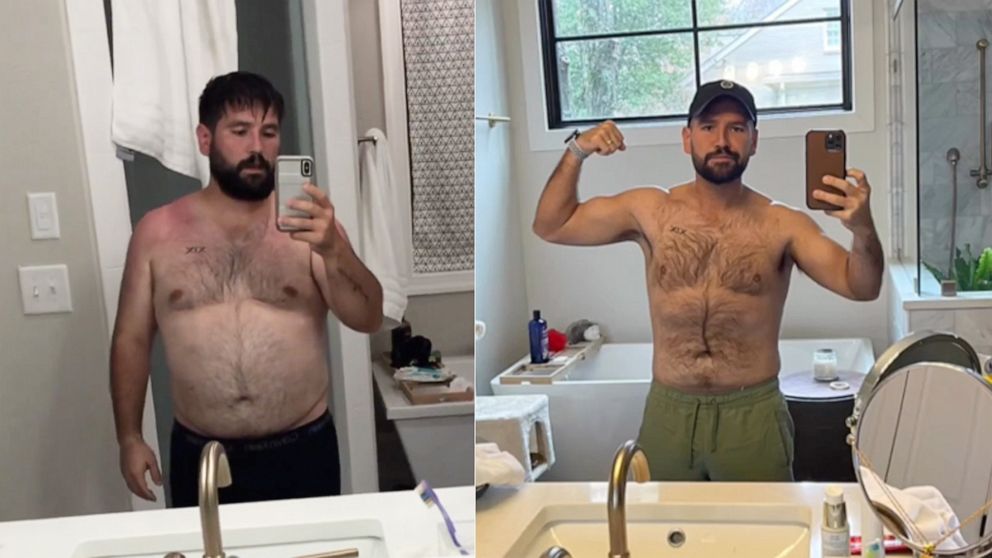 PHOTO: Shay Mooney opens up about his weight loss journey.