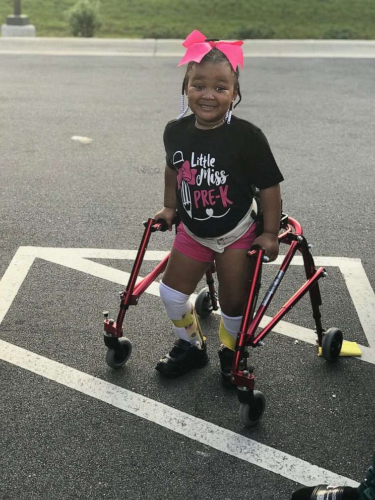 PHOTO: Kinley, 4, daughter of Shanell Jones of Fayetteville, North Carolina, was diagnosed with cerebral palsy at the age of 2. 