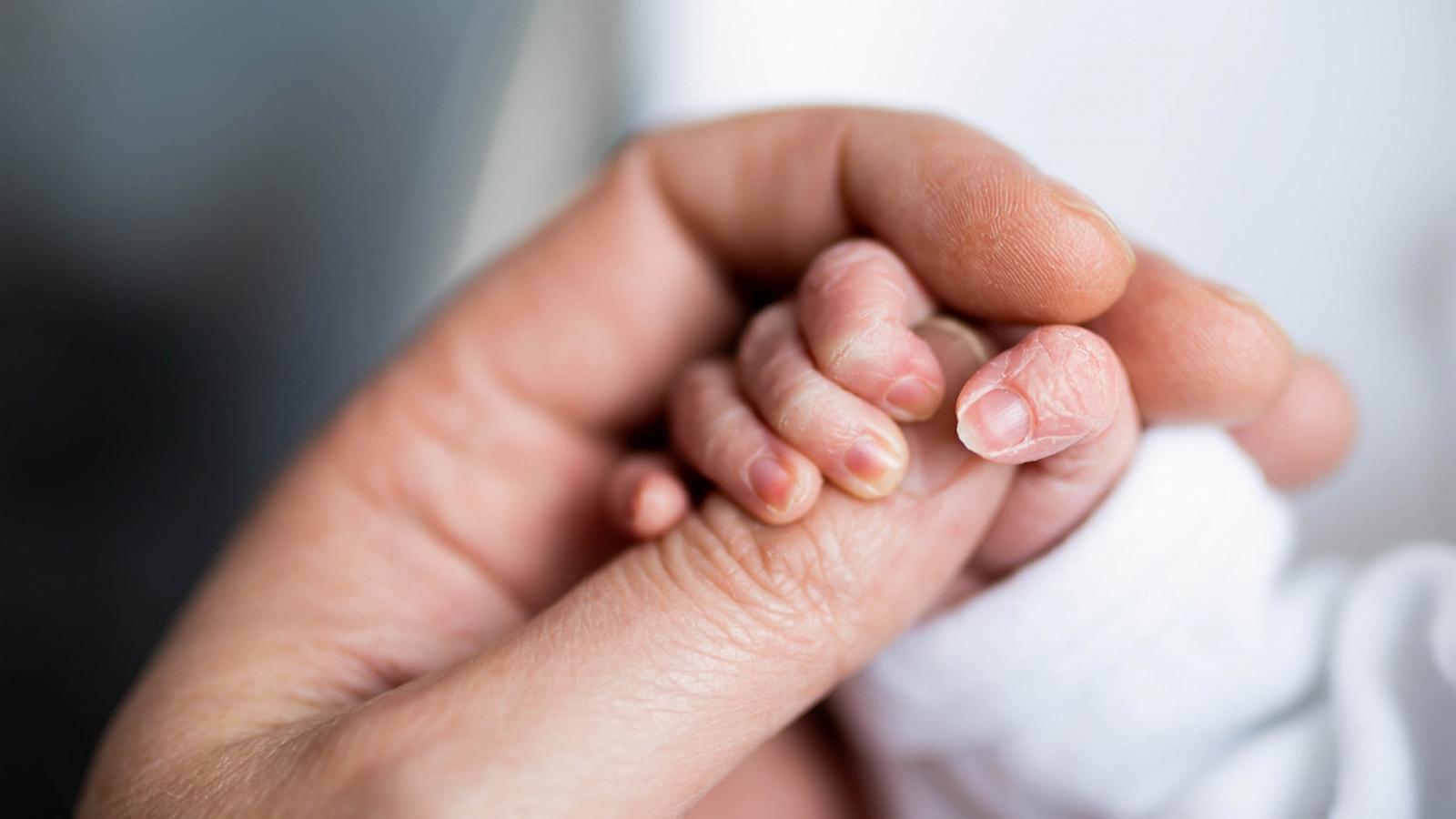 PHOTO: For babies born prematurely, early skin-to-skin contact may have significant health benefits, according to a new study.