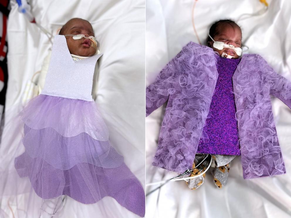 PHOTO: Babies in the neonatal intensive care unit at Children’s Hospital New Orleans are dressed up in honor of Taylor Swift’s Eras Tour stops in the Crescent City.