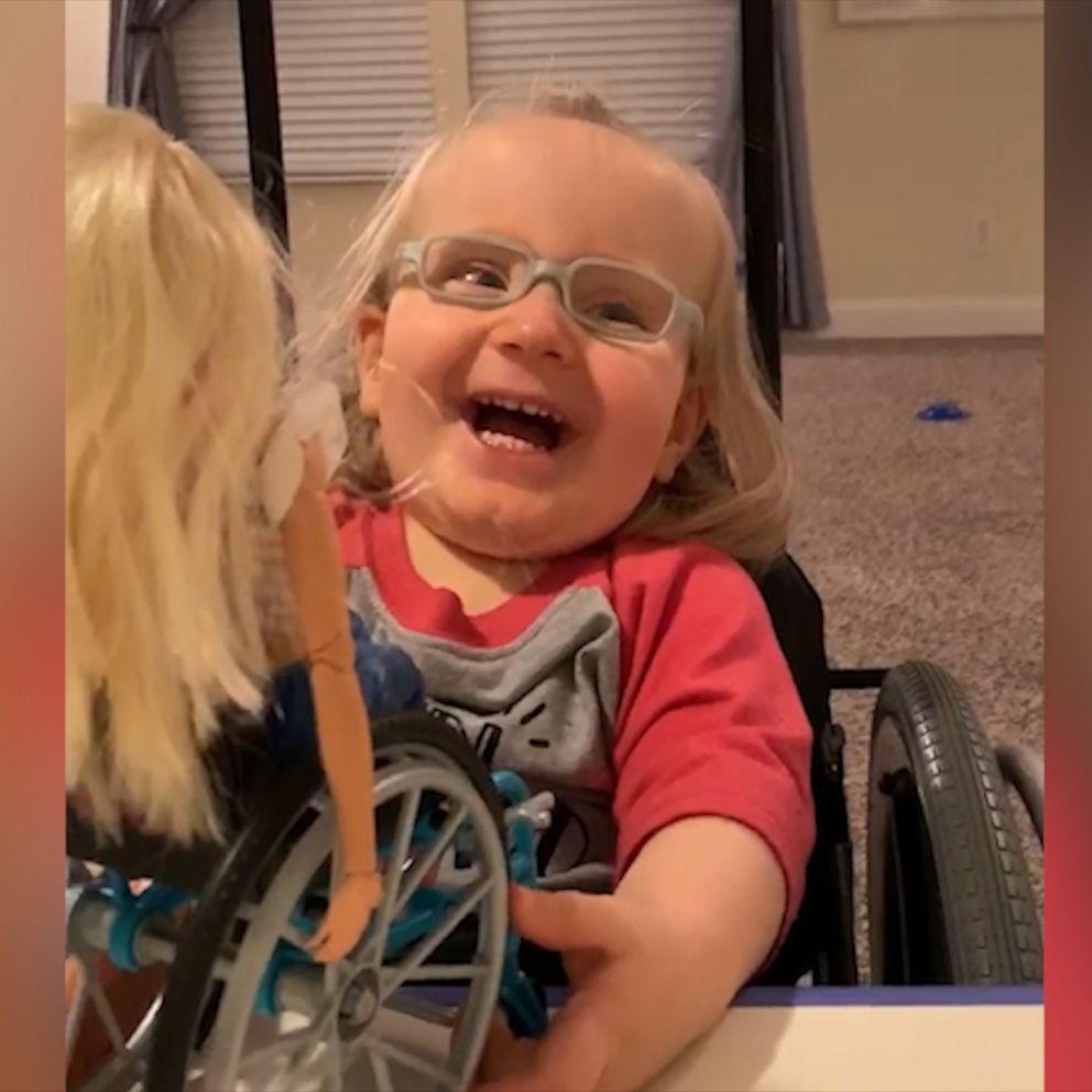 VIDEO: Girl with spina bifida has sweetest reaction to Barbie that's 'just like her' 