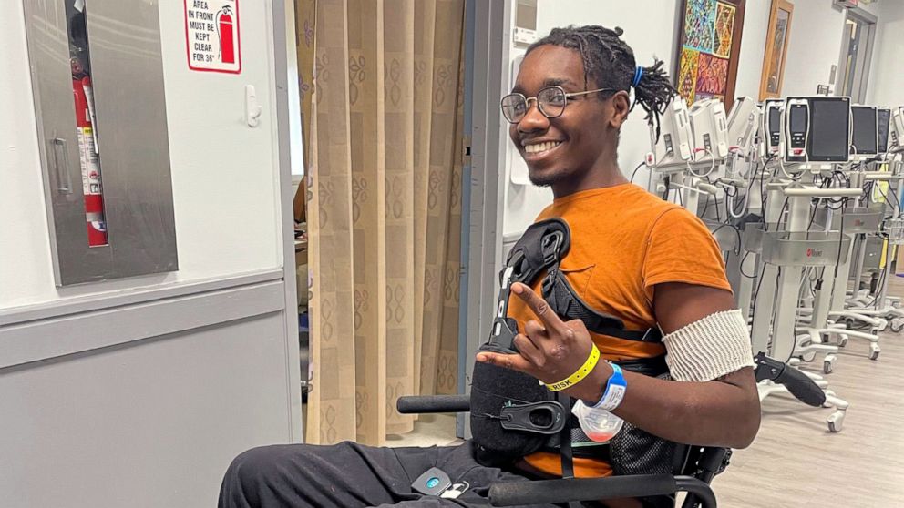 PHOTO: Cory Moses, of New York, relearned how to walk at Mount Sinai Health System after being injured in a bicycle crash.