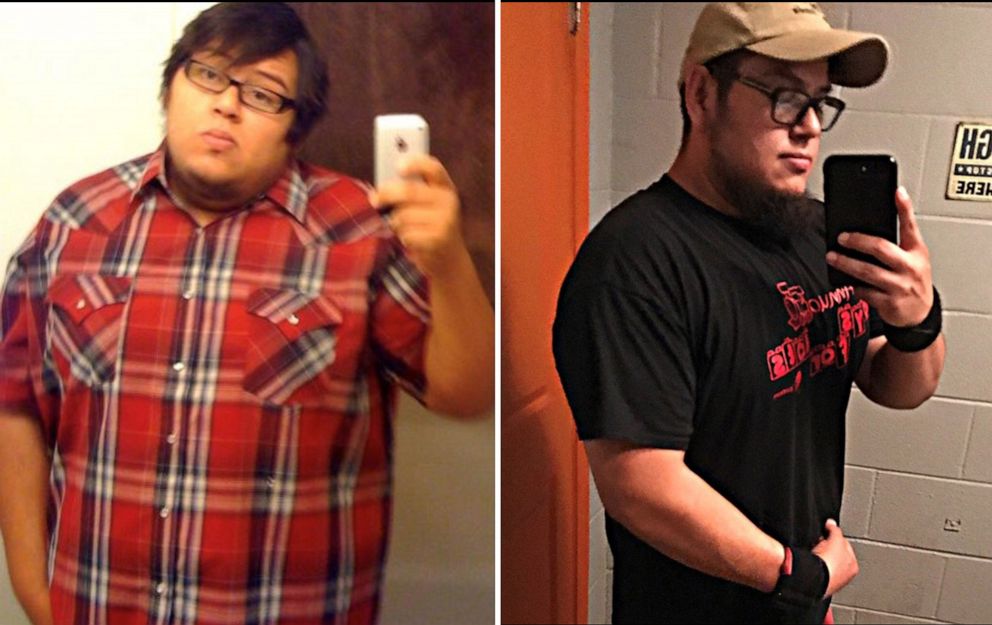 PHOTO: Abe Pena, of Texas, has lost more than 100 pounds.
