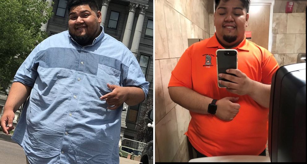 PHOTO: Gus Pena, of Texas, has lost more than 100 pounds.