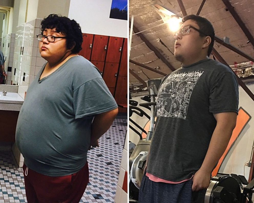 PHOTO: Rudy Pena, of Texas, has lost more than 100 pounds.