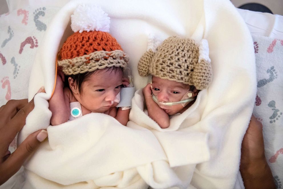 PHOTO: Twins Camden and Callie Riley are 1 of 12 sets of twins in care at Saint Luke's Hospital in Kansas City, Mo.