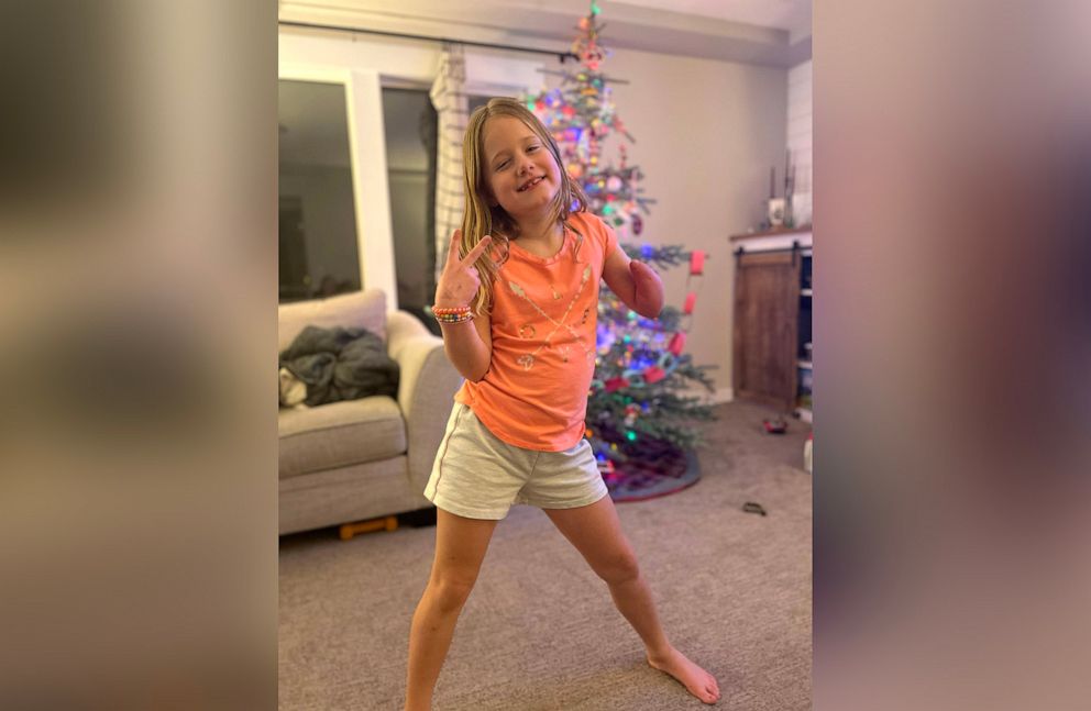 PHOTO: 8-year old Raegan Justesen and teacher Leah Kaplan bonded over shared limb difference.