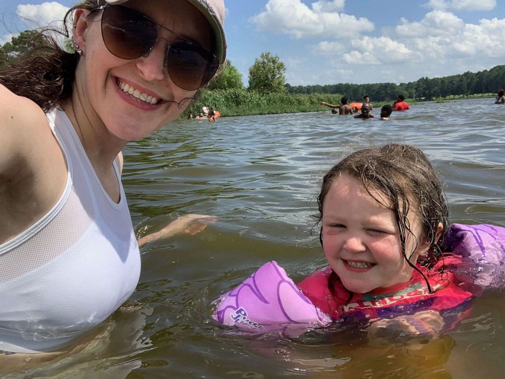PHOTO: Megan Doss, a mother of three from Georgia, poses with her daughter Caroline, 3, in a photo dated Aug. 1, 2020. Doss shared an image with her 11,500 Instagram followers of Caroline when she had an apparent allergic reaction to sunscreen.