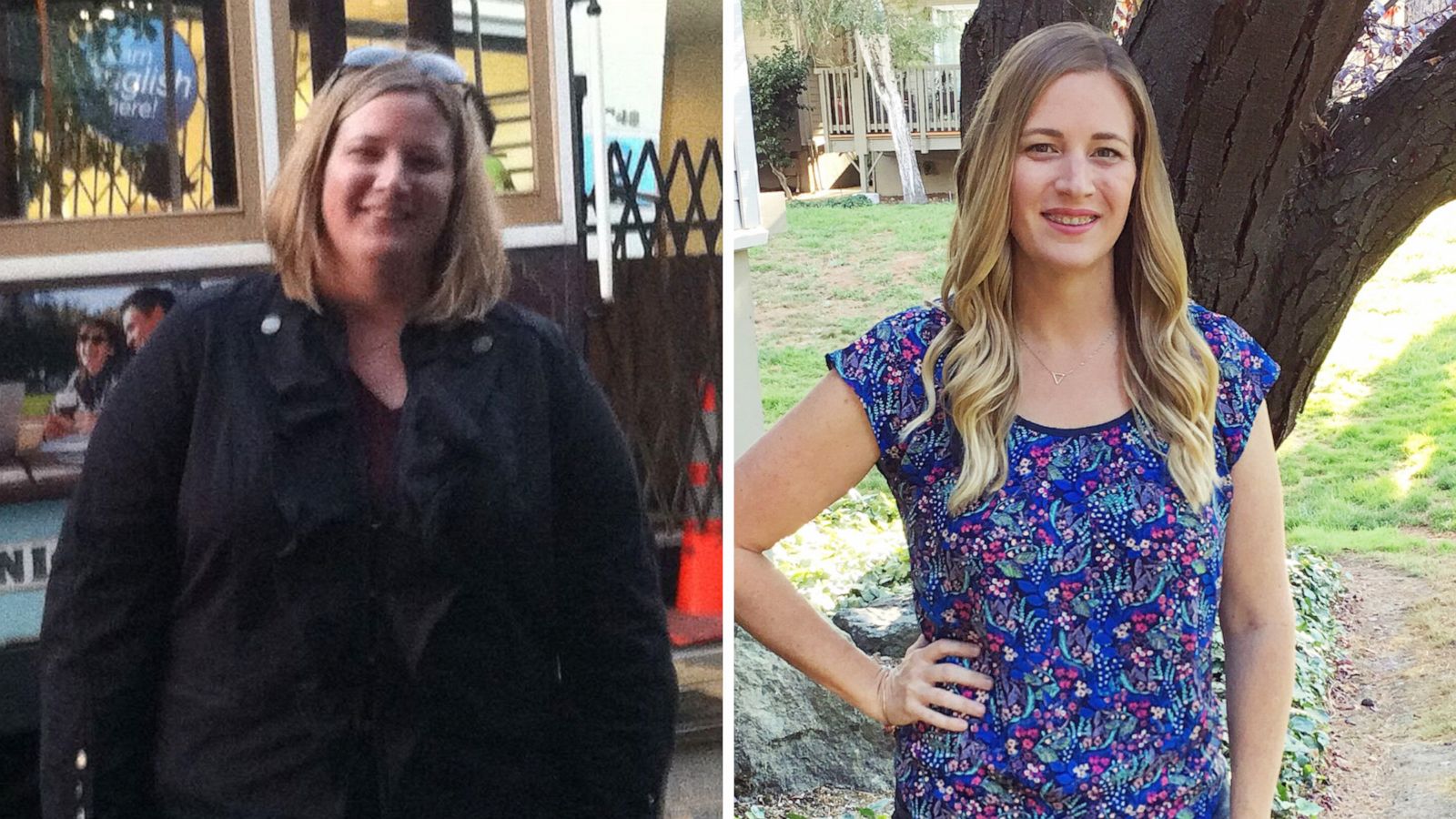 PHOTO: Suzanne Ryan lost more than 100 pounds following a ketogenic diet.