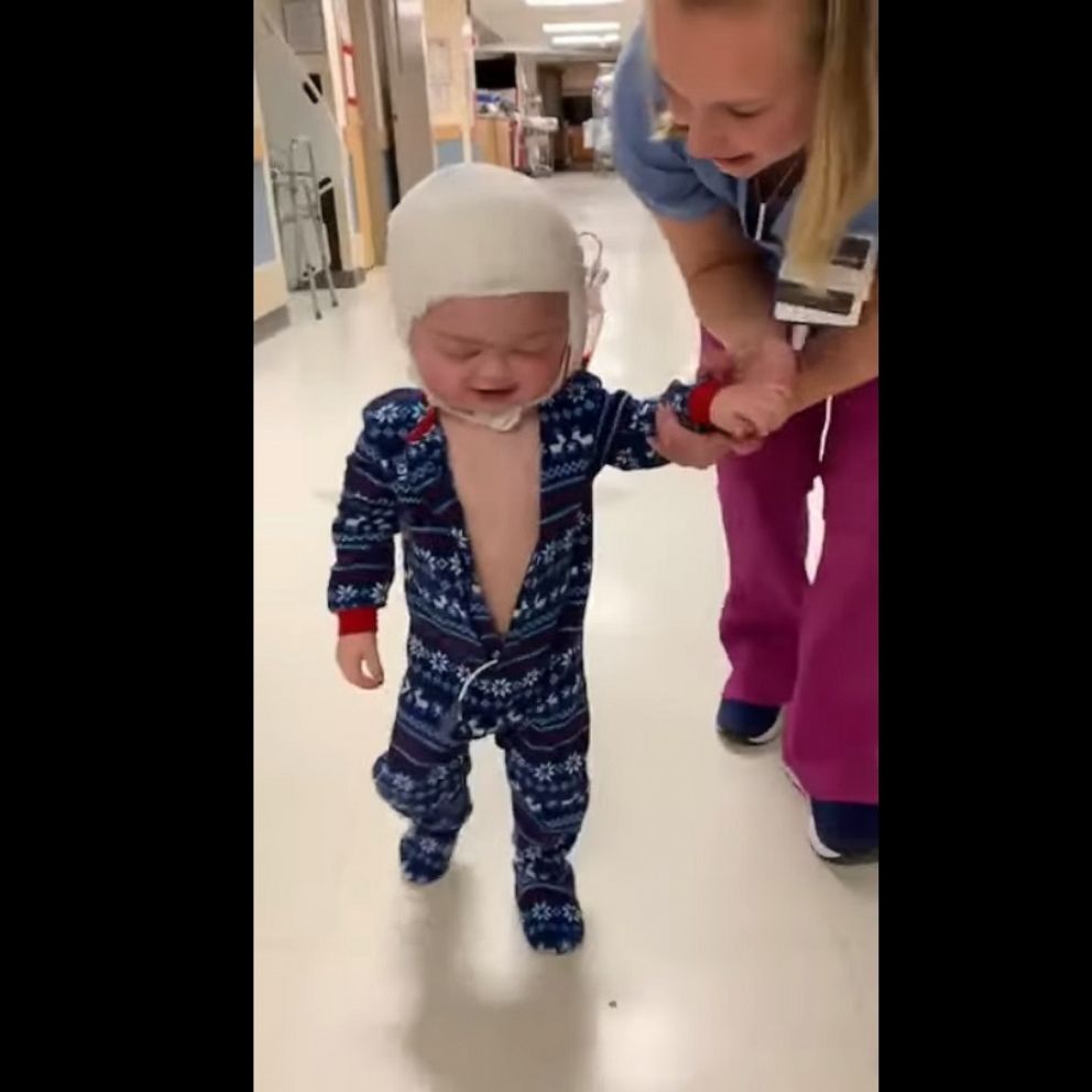 VIDEO: Emotional video shows toddler taking first steps since surgery