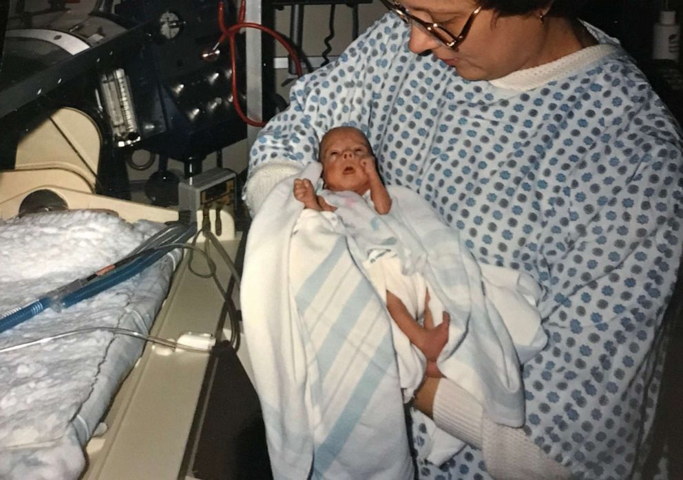 PHOTO: Tammy Lewis of Belton, Texas, is pictured with her mother in 1985 at Baylor Scott & White Health in Temple, Texas, where she was born 3 months early.