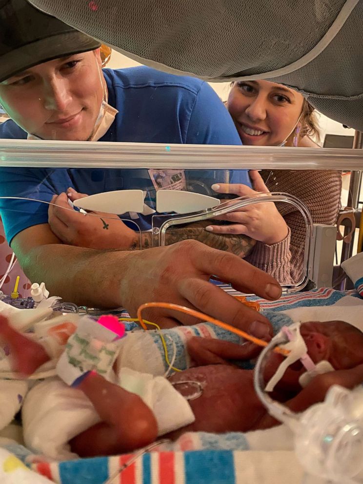 PHOTO: Taylor Davis said she and her husband, Mark, decided to "do everything" they could to save their twins, Avery and Emersyn, who were born around 22 weeks.
