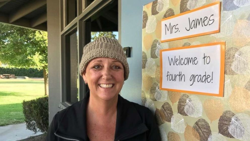 PHOTO: Katherine James, of Santa Barbara, California, completed chemotherapy on Sept. 11, 2018.