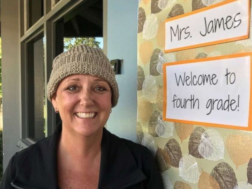 PHOTO: Katherine James, of Santa Barbara, California, completed chemotherapy on Sept. 11, 2018.