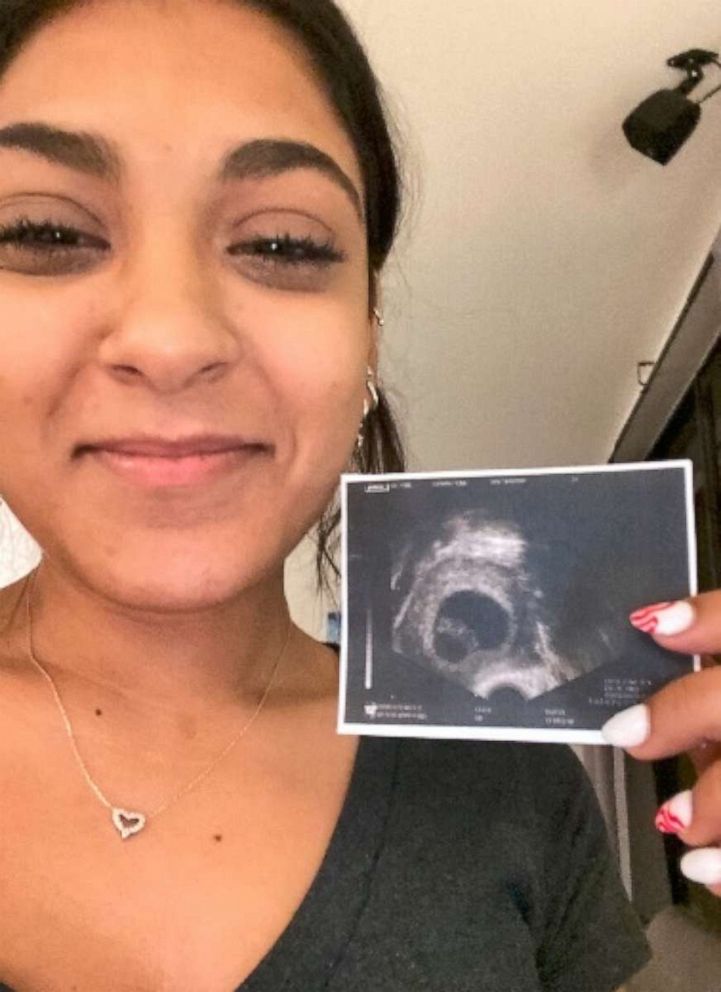 PHOTO: In a now-viral video seen by millions, Ana Mello, 20, of Coconut Creek, Florida, shared her and her 17-year-old brother Lucas' reaction onto TikTok after her parents' big reveal. Mom Vanessa and dad Jocelyn Mello, 42, are expecting in July 2021.