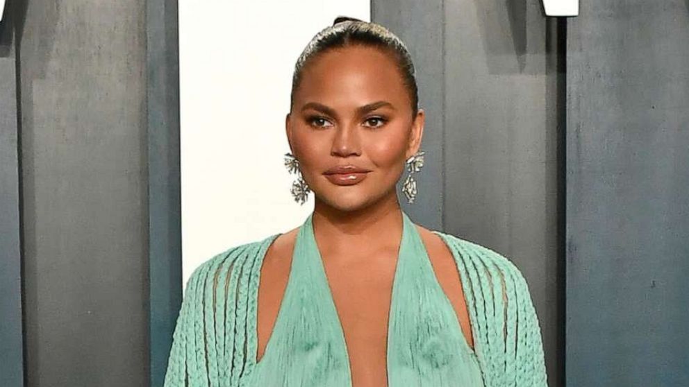 Chrissy Teigen says her 2020 miscarriage was an abortion