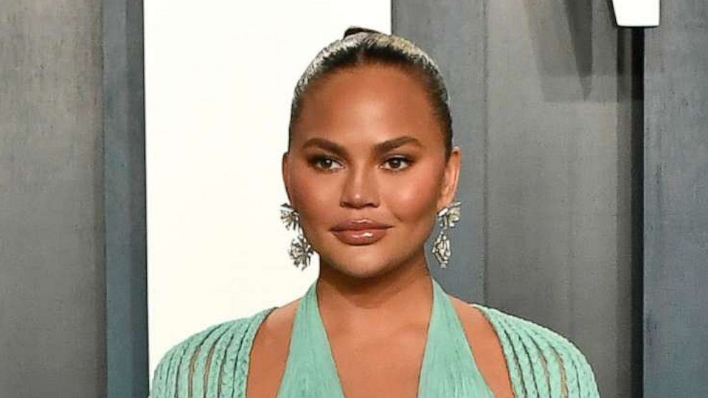 PHOTO: Chrissy Teigen attends an event on Feb. 9, 2020, in Beverly Hills, Calif.