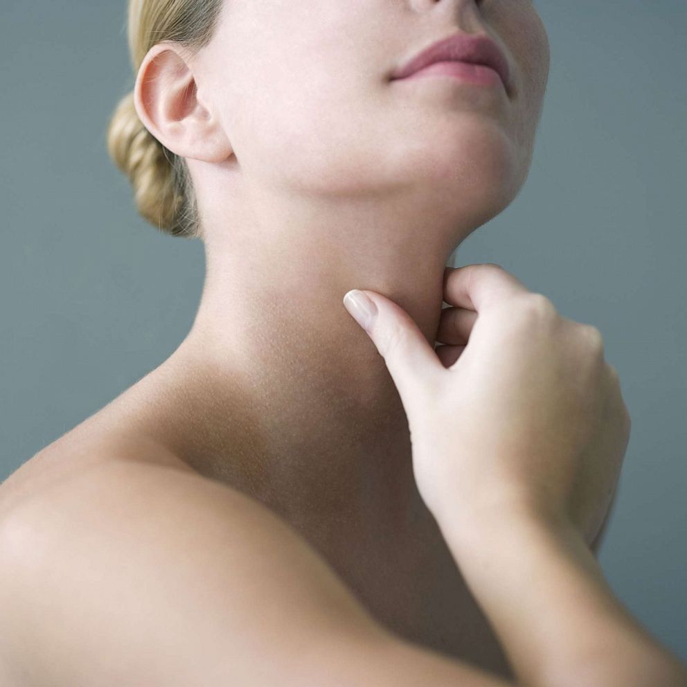 VIDEO: Thyroid Cancer Awareness Month: How to check for the increasingly occuring disease