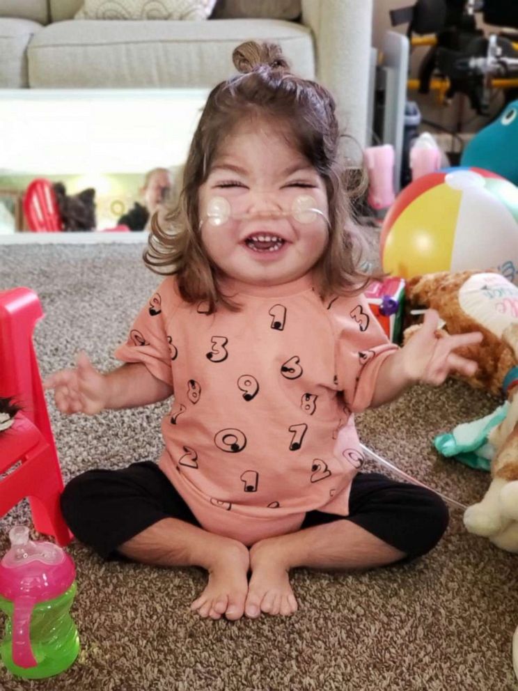 PHOTO: Emmett Hightshoe was diagnosed with Kabuki syndrome in utero. It’s a rare genetic disorder impacting organ development, as well as her physical and cognitive abilities.  