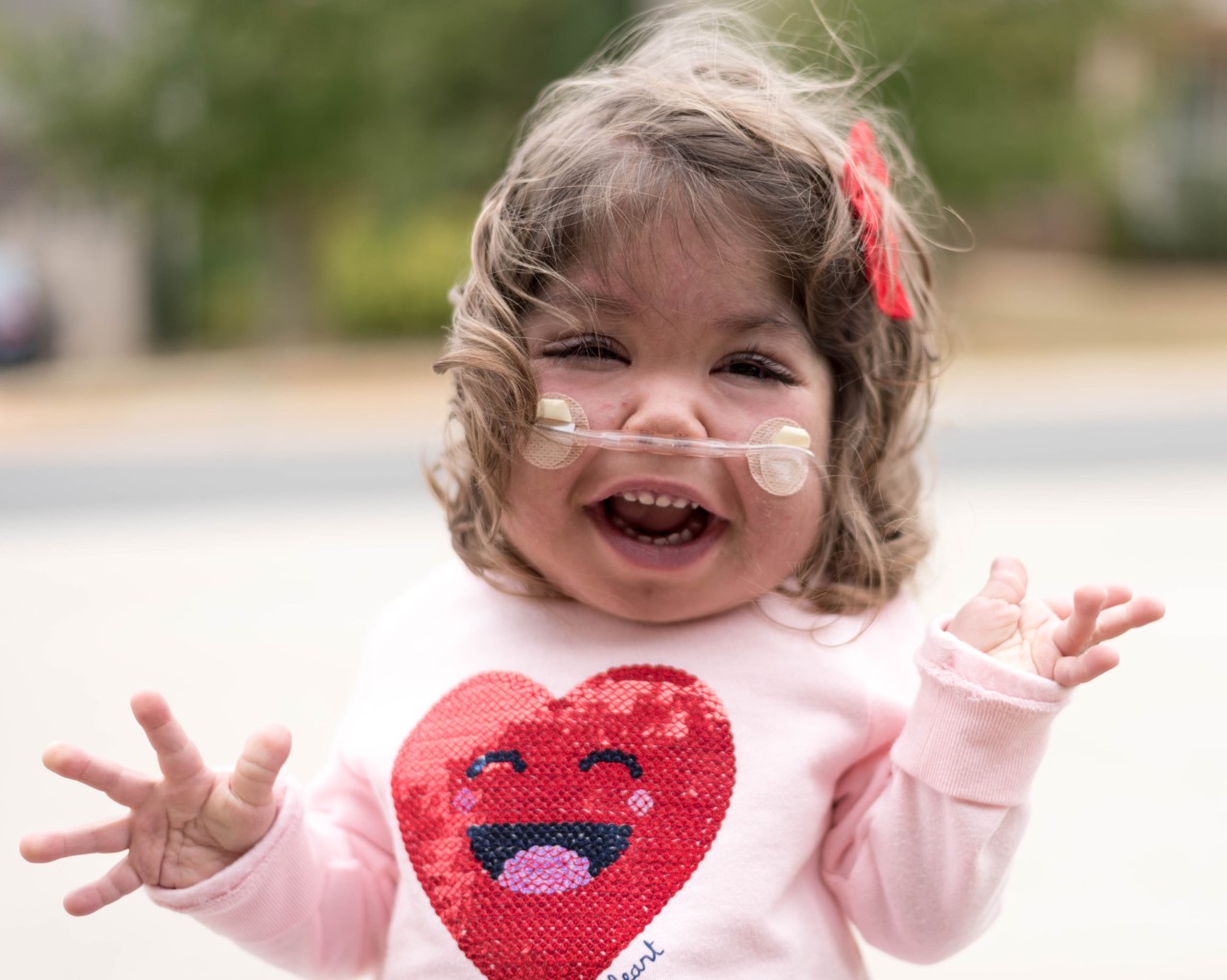 PHOTO: Emmett Hightshoe was diagnosed with Kabuki syndrome in utero. It’s a rare genetic disorder impacting organ development, as well as her physical and cognitive abilities.
