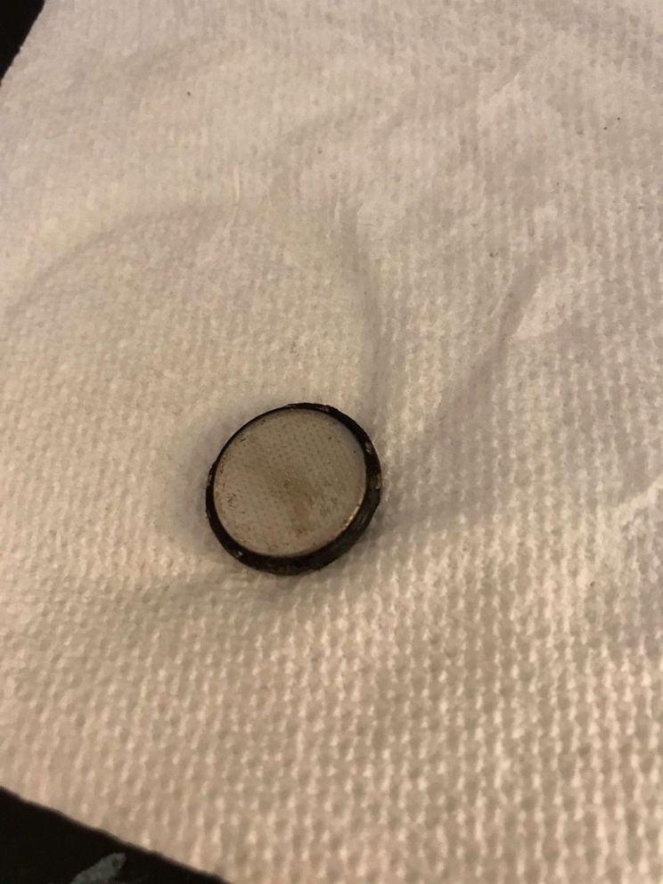 PHOTO: A toddler named Mahziere, 1, accidentally ingested a button battery, which was surgically removed on Sept. 24 at IU Health Riley Hospital for Children in Indianapolis, Indiana. Seen in this undated photo is the battery which Mahziere swallowed.