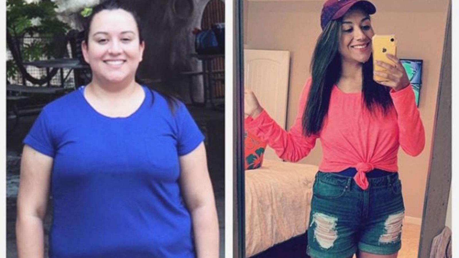 PHOTO: This woman underwent an incredible weight loss transformation.