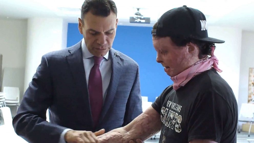 PHOTO: Joe DiMeo is pictured with Dr. Eduardo D. Rodriguez of NYU Langone Health prior to DiMeo's face and double hand transplant.
