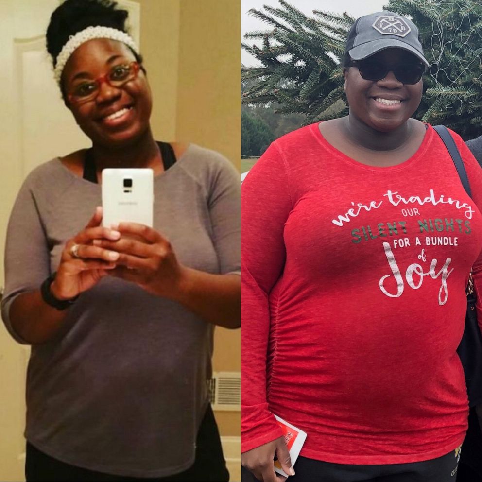 PHOTO: Tricia Bryan, 34, of Conyers, Georgia, has lost nearly 60 pounds.
