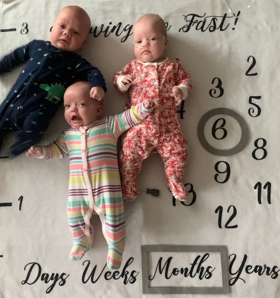 PHOTO: Natashia, Arya and Trae Peterson, 7 months, were born June 13, 2019, in Nebraska.