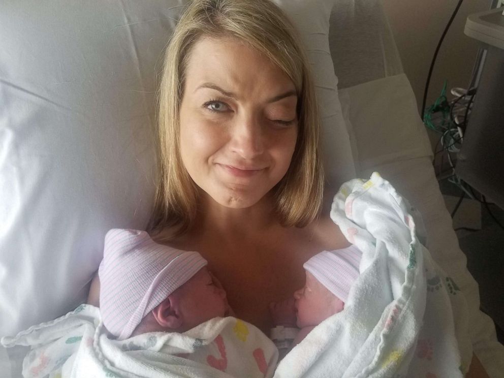 Baby Born 'Pregnant' With Her Own Twins