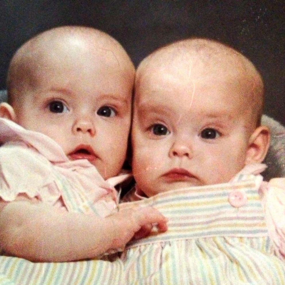 PHOTO: Jalynne Crawford and Janelle Leopoldo as babies.