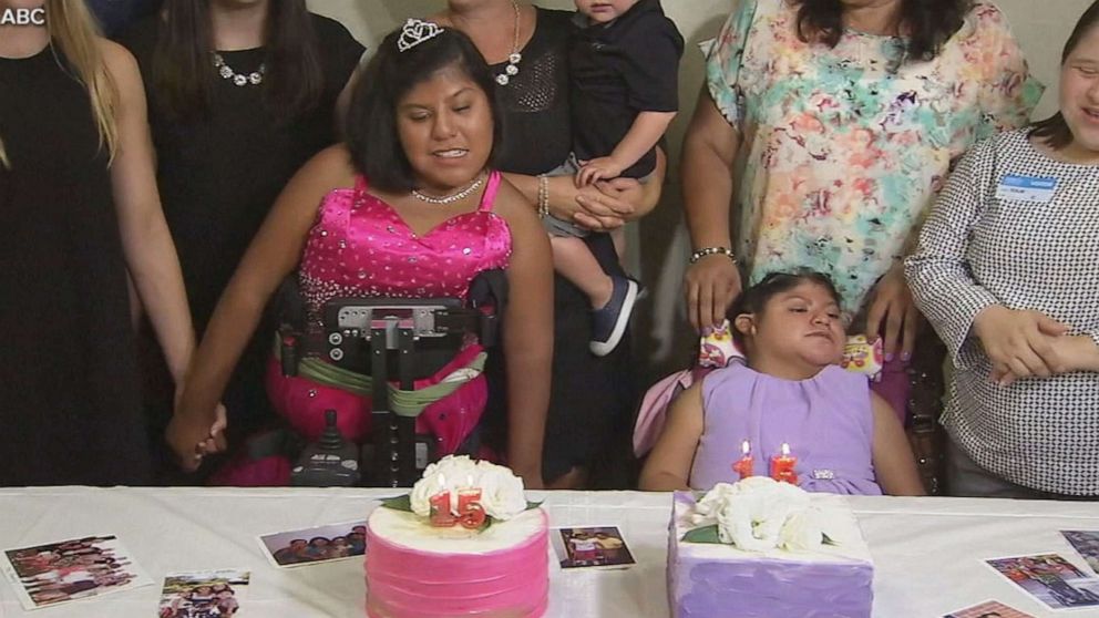 PHOTO: Formerly conjoined twins Josie Hull and Teresa Cajas celebrate their 15th birthdays.