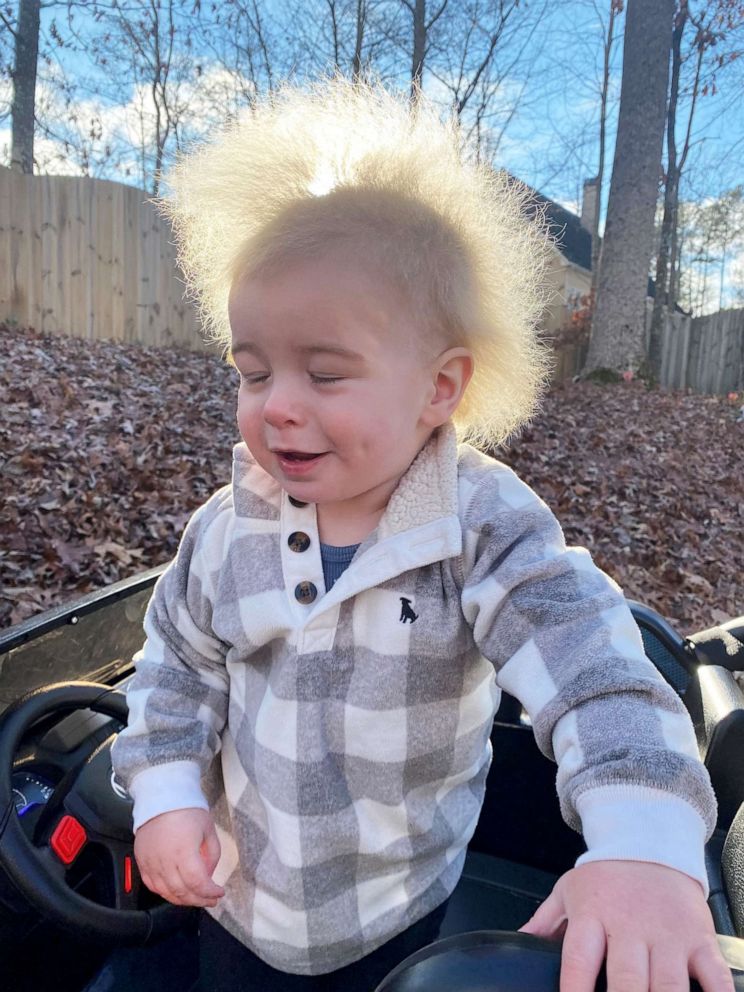 PHOTO: Locklan Samples, who has a rare disorder called uncombable hair syndrome, is pictured in a family photo near Atlanta., Dec. 19, 2021. 