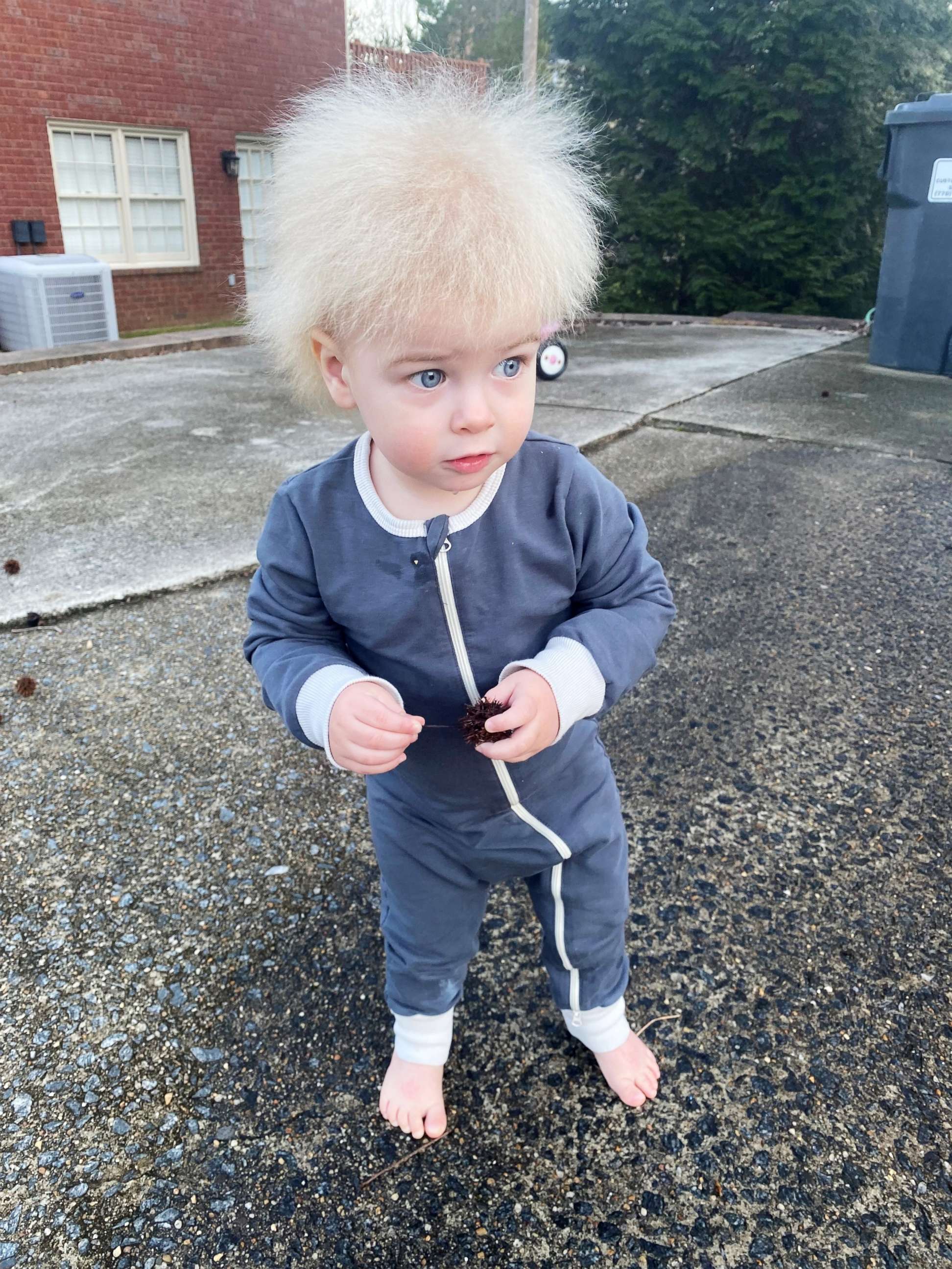 PHOTO: 1 year old Locklan Samples, who has a rare disorder called uncombable hair syndrome, is pictured in a family photo near Atlanta, Feb. 23, 2022.