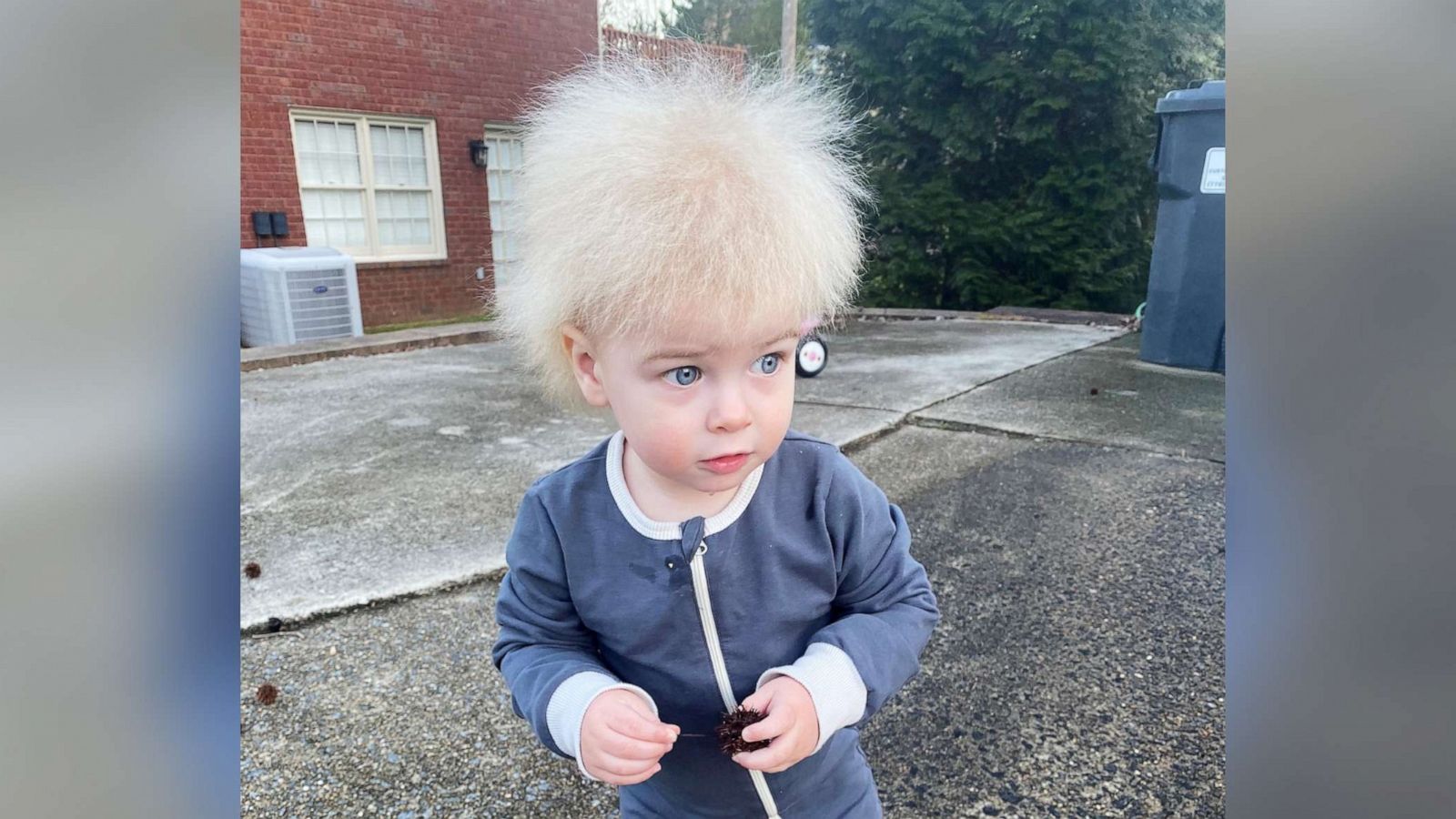 Mom raises awareness after son is diagnosed with uncombable hair syndrome -  Good Morning America